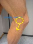 rodilla2x.jpg