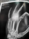20140823_radiografia_IMG_20140823_205905.jpg