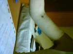 brazo [Resolucion de Escritorio].jpg