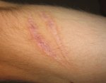 m_767px-Scar_(xndr).jpg