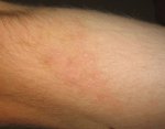 m_767px-Scar_(xndr)2.jpg