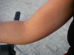 alergia-10 (Small).jpg