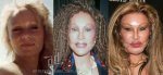 jocelyn_wildenstein_antes_y_despues_cirugia.jpg