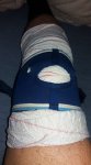 rodilla.jpg