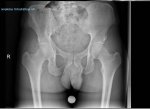 pelvis.jpg