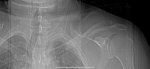 00DF5B55-1ABD-4716-A3D7-176AE48850D3.jpeg