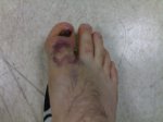 09072007031dedo.jpg