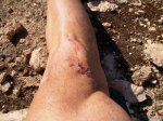 Heridas 1.jpg
