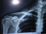 clavicula.jpg