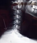 vertebra.jpg