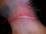 cuello1.jpg