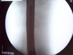 100_0198.JPG