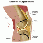 rodilla.gif