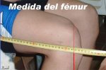 rodilla2.JPG