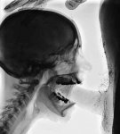 radiografia_jpg.jpg