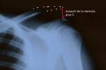 radiografia copy.jpg
