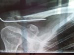 Ãltima radiografÃ­a.jpg