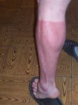 100_1471.jpg